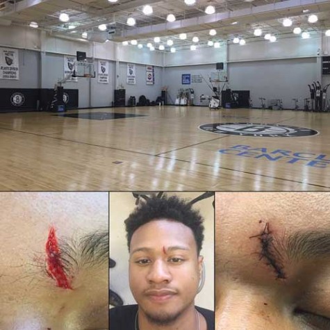 Bobby Ray Parks injured in Brookly Nets workout